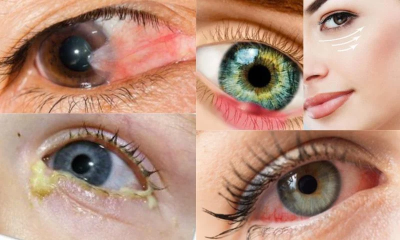 Göz Çizdirmek Tedavi Yöntemi Midir?