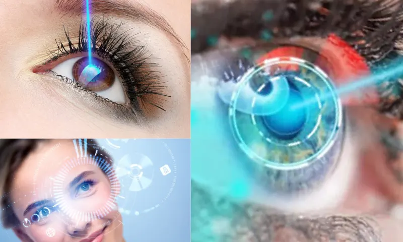 Lazer Göz Çizimi Tedavisi Nedir?