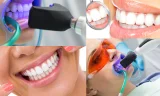Diş Beyazlatma Nedir ve Neden Tercih Edilir?