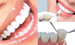 Zirkonyum Diş Kaplama Kimler İçin Uygundur?