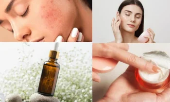 Cilt Bakımının Sessiz Kahramanı: Salisilik Asit Nedir?