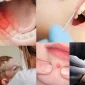Apse Başka Bir Hastalığın Belirtisi Olabilir Mi?