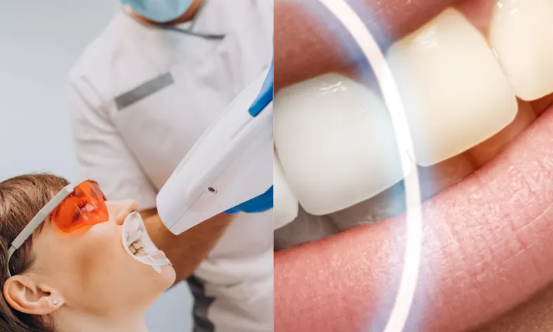 dişbeyazlatma-2-li-1